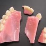 Read more about the article Same-Day Denture Repair in Peabody, MA – Fast, Reliable & Local