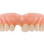 Read more about the article Same-Day Denture Repair in Middleton, MA – Get Back to Smiling Today